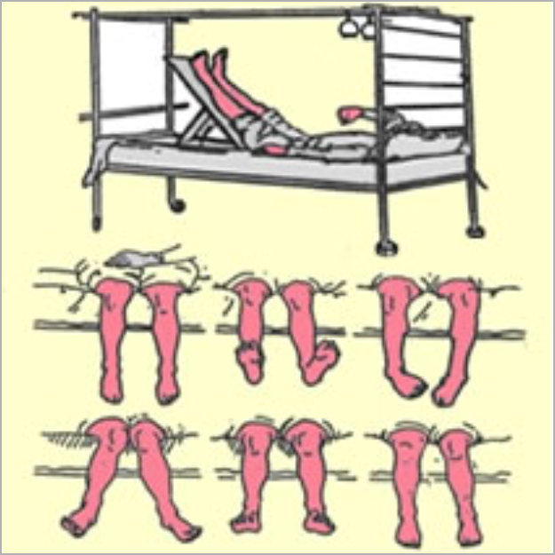 Ejercicios para Rehabilitación Física en Toluca y Metepec